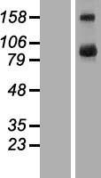 ls125058 tbc1d16 human over expression lysates nm 019020 wb testing 1