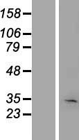 KRT222P (KRT222) Human Over-expression Lysates NM_152349