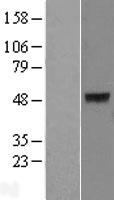ls125115 keratin 40 krt40 human over expression lysates nm 182497 wb testing 1