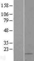 ls125144 snhg29 human over expression lysates nm 152350 wb testing 1