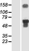 SMCR7 (MIEF2) Human Over-expression Lysates NM_139162