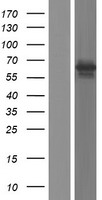 LOXHD1 Human Over-expression Lysates NM_001145473
