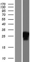 ls125476 ino80c human over expression lysates nm 001098817 wb testing 1
