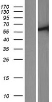 TTC39C Human Over-expression Lysates NM_153211