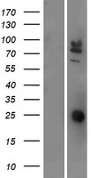 ls125931 ceacam20 human over expression lysates nm 001102597 wb testing 1