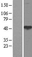 Calreticulin 3 (CALR3) Human Over-expression Lysates NM_145046