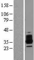 ls126014 oscar human over expression lysates nm 133169 wb testing 2