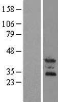 ls126014 oscar human over expression lysates nm 206818 wb testing 1
