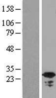 SWSAP1 Human Over-expression Lysates NM_175871