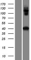 ls126075 ccdc159 human over expression lysates nm 001080503 wb testing 1