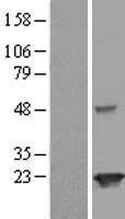 ls126119 josephin 2 josd2 human over expression lysates nm 138334 wb testing 1