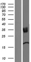 TMIGD2 Human Over-expression Lysates NM_001169126