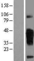 TMIGD2 Human Over-expression Lysates NM_144615