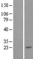 ZNF428 Human Over-expression Lysates NM_182498