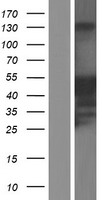 JSRP1 Human Over-expression Lysates NM_144616