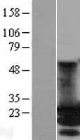 MOBKL2A (MOB3A) Human Over-expression Lysates NM_130807