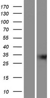 GIPC3 Human Over-expression Lysates NM_133261