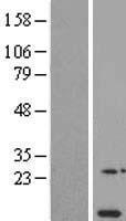 NDUFA11 Human Over-expression Lysates NM_175614