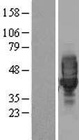 LRRC25 Human Over-expression Lysates NM_145256