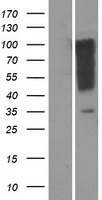 ls126370 or1i1 human over expression lysates nm 001004713 wb testing 1
