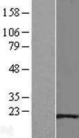Hsp20 (HSPB6) Human Over-expression Lysates NM_144617