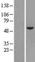 CYP4F22 Human Over-expression Lysates NM_173483