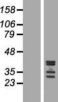 C19orf47 Human Over-expression Lysates NM_178830