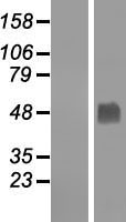 GABPB2 Human Over-expression Lysates NM_144618