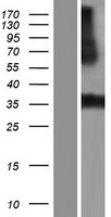 LRRC38 Human Over-expression Lysates NM_001010847