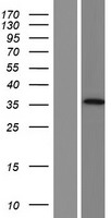 AADACL3 Human Over-expression Lysates NM_001103169