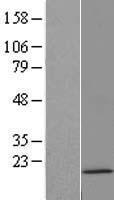 ls126961 h3c14 human over expression lysates nm 021059 wb testing 1