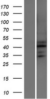 ATXN7L2 Human Over-expression Lysates NM_153340