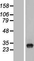TYW3 Human Over-expression Lysates NM_138467