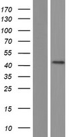 OTX3 (DMBX1) Human Over-expression Lysates NM_172225