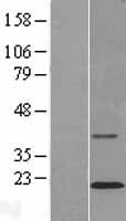 TMCO2 Human Over-expression Lysates NM_001008740