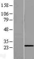 C1orf83 (TCEANC2) Human Over-expression Lysates NM_153035