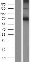 ls127435 podn human over expression lysates nm 001199082 wb testing 2