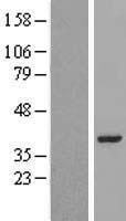 LRRC39 Human Over-expression Lysates NM_144620