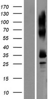 TEDDM1 Human Over-expression Lysates NM_172000