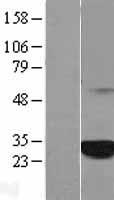 C1orf216 Human Over-expression Lysates NM_152374