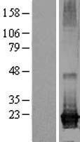ls127829 arl8a human over expression lysates nm 138795 wb testing 1