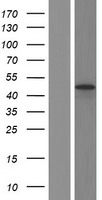 KIST (UHMK1) Human Over-expression Lysates NM_144624