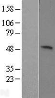 KIST (UHMK1) Human Over-expression Lysates NM_175866