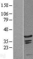 C1orf131 Human Over-expression Lysates NM_152379