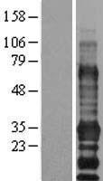 EDARADD Human Over-expression Lysates NM_145861