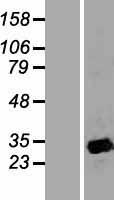 APOA1BP (NAXE) Human Over-expression Lysates NM_144772