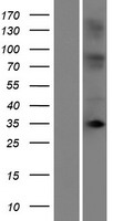 OR10T2 Human Over-expression Lysates NM_001004475