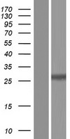 TATDN3 Human Over-expression Lysates NM_001146169