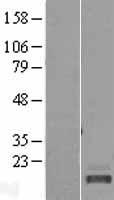C20orf85 Human Over-expression Lysates NM_178456