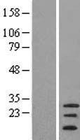 C20orf141 Human Over-expression Lysates NM_080739